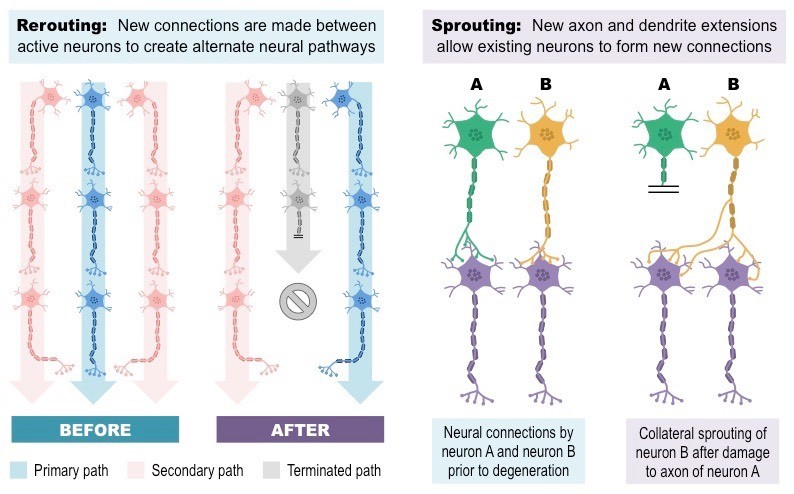 Diagram depicting neuroplasticity in the human brain