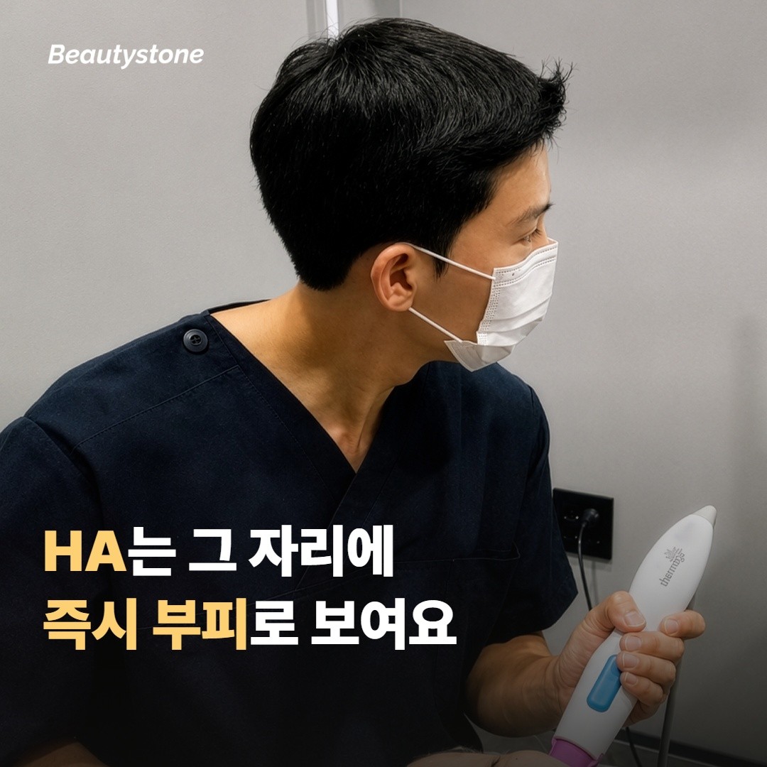 즉시 채우는 방식과 시간 두고 만드는 방식