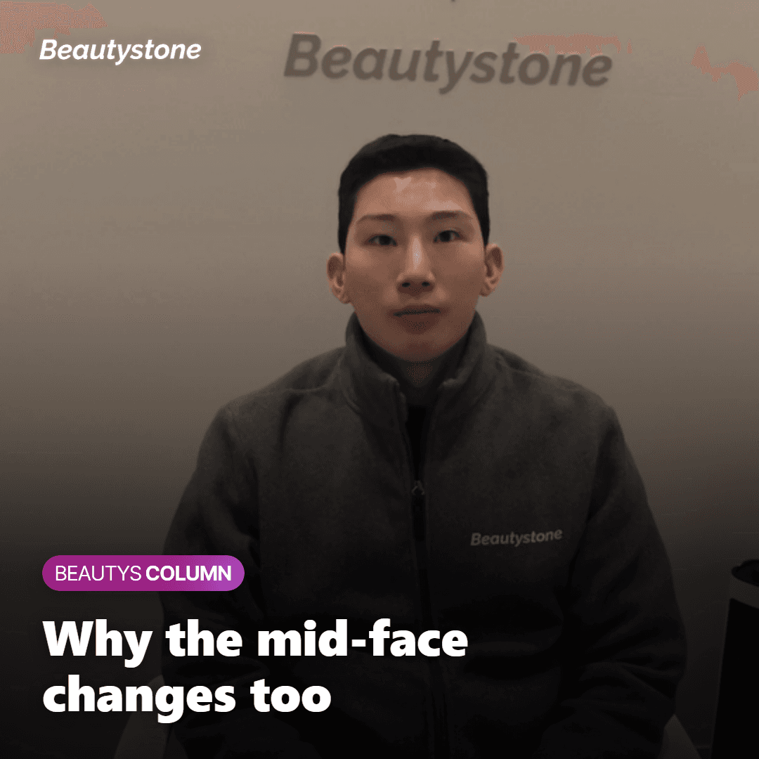 Illustration of why the mid-face can look hollow after masseter Botox