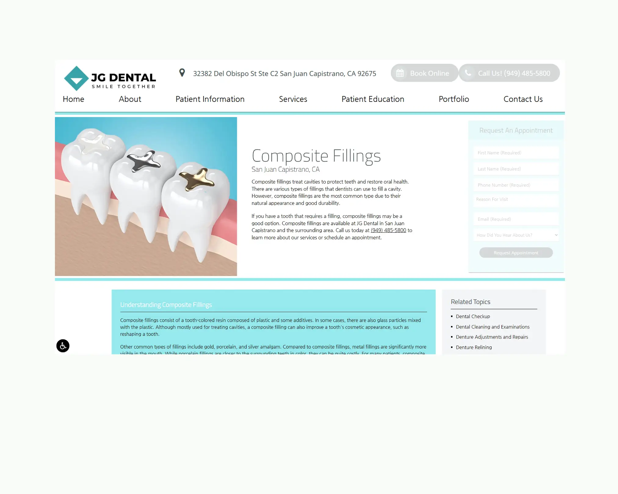JG Dental webpage for composite fillings with tooth graphic and benefits