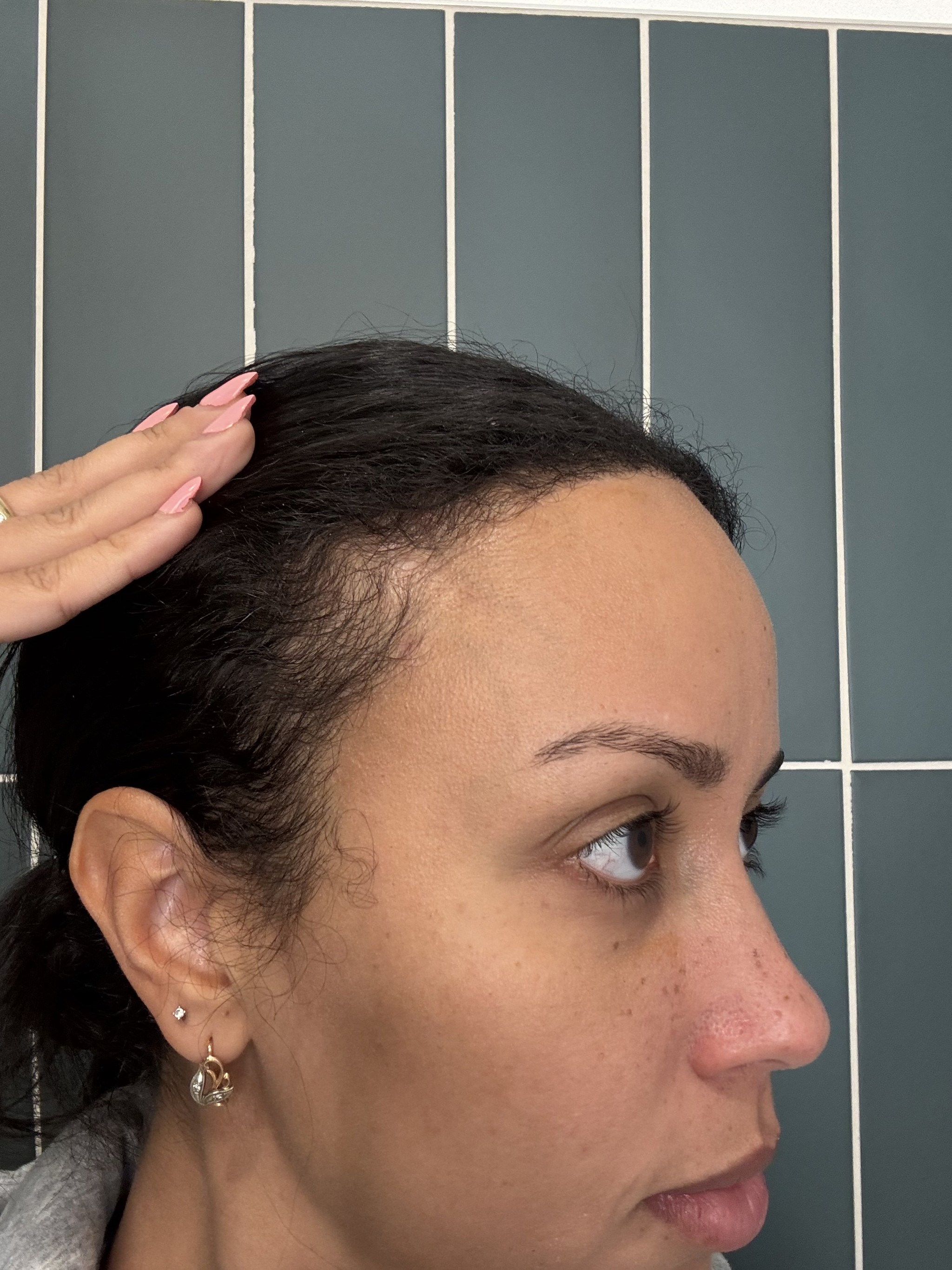 Natural hair growth products for women