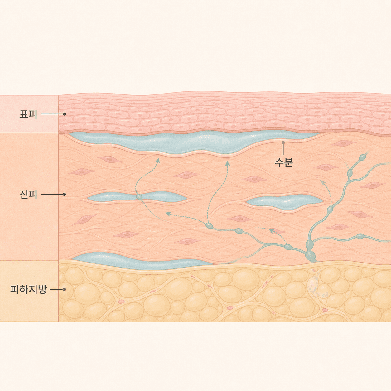 얼굴 조직 사이에 수분이 고여 붓기가 생기는 모습이에요