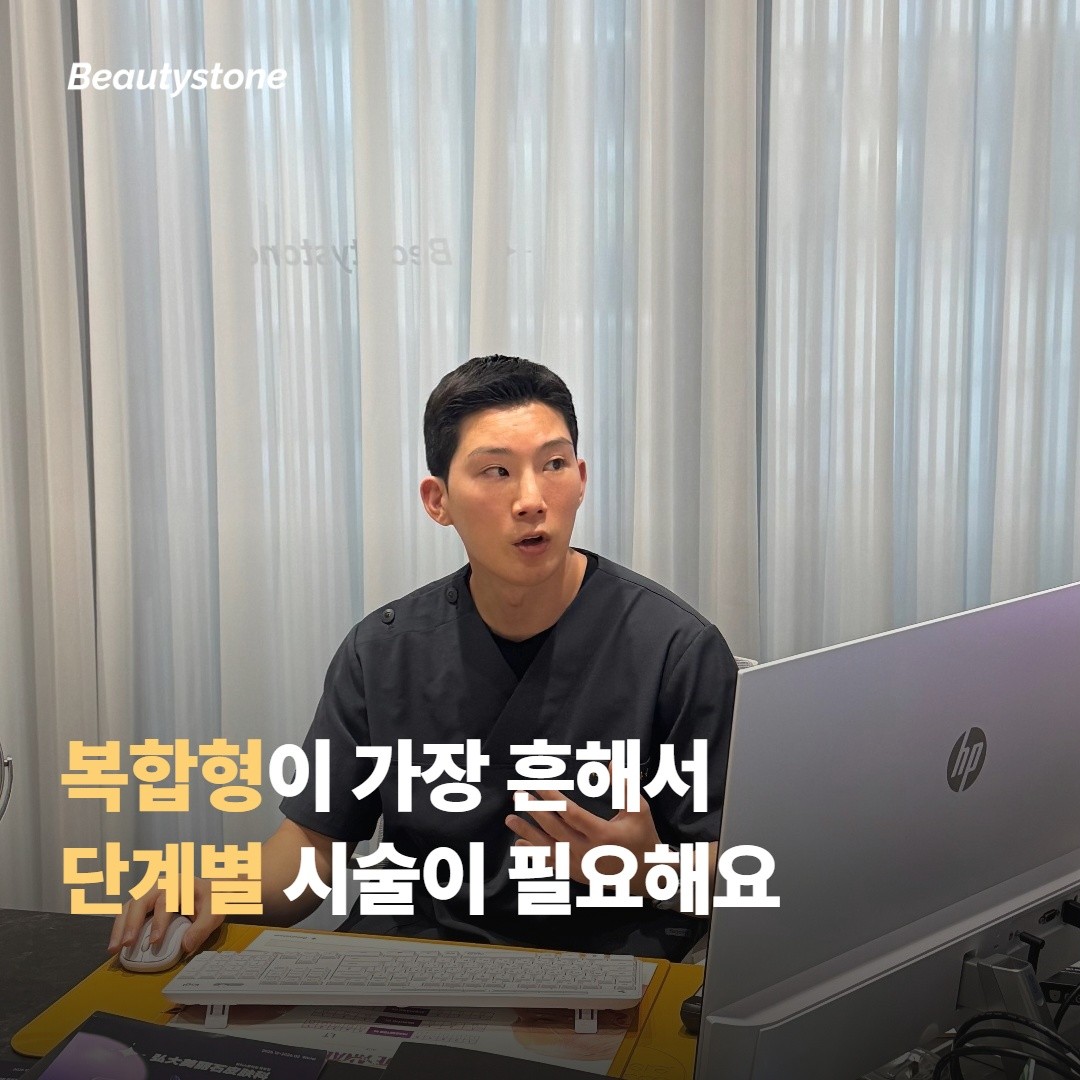 구조형 — 패임이 만드는 그림자