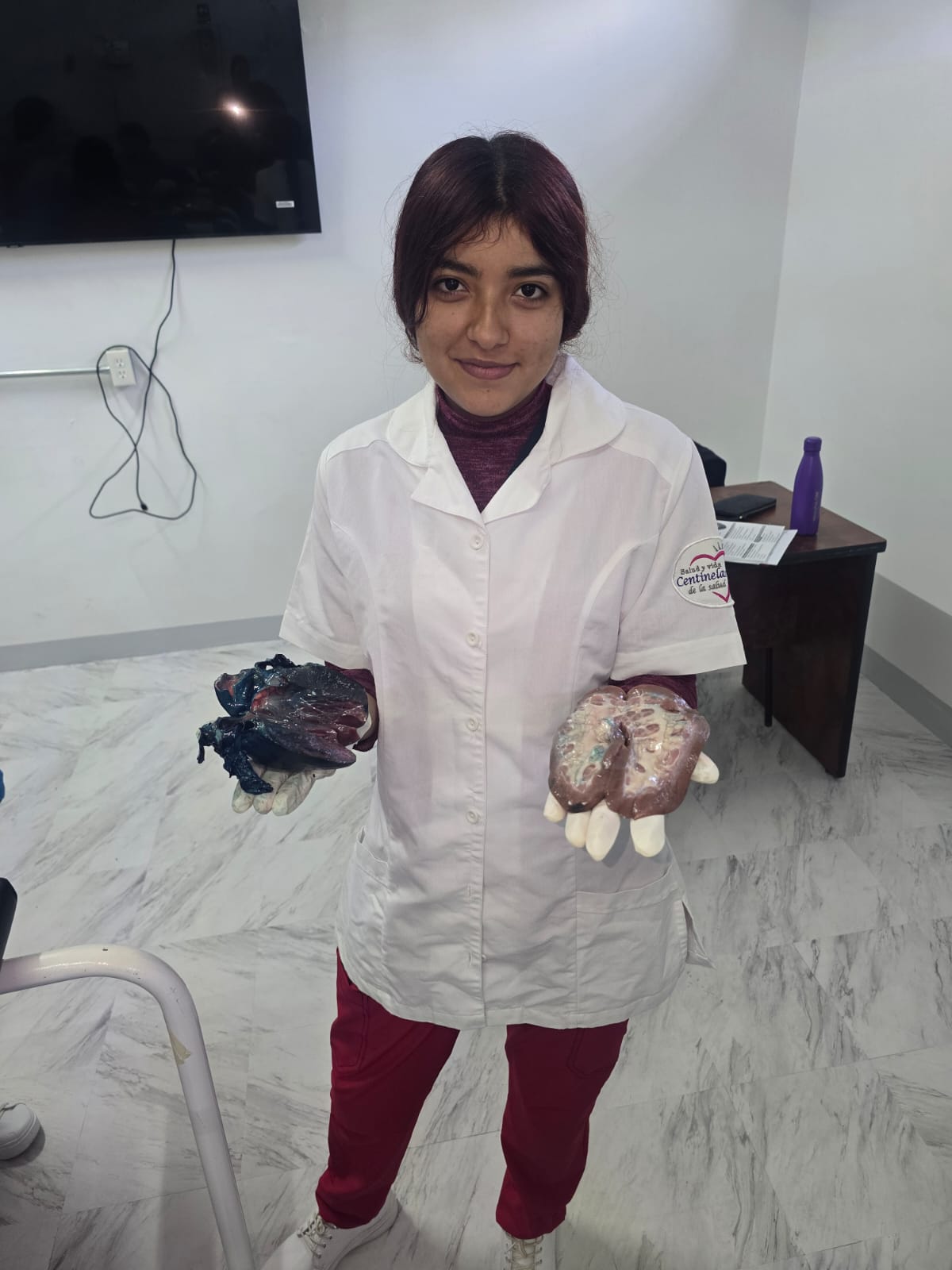Scientist examining a blood sample in a lab.