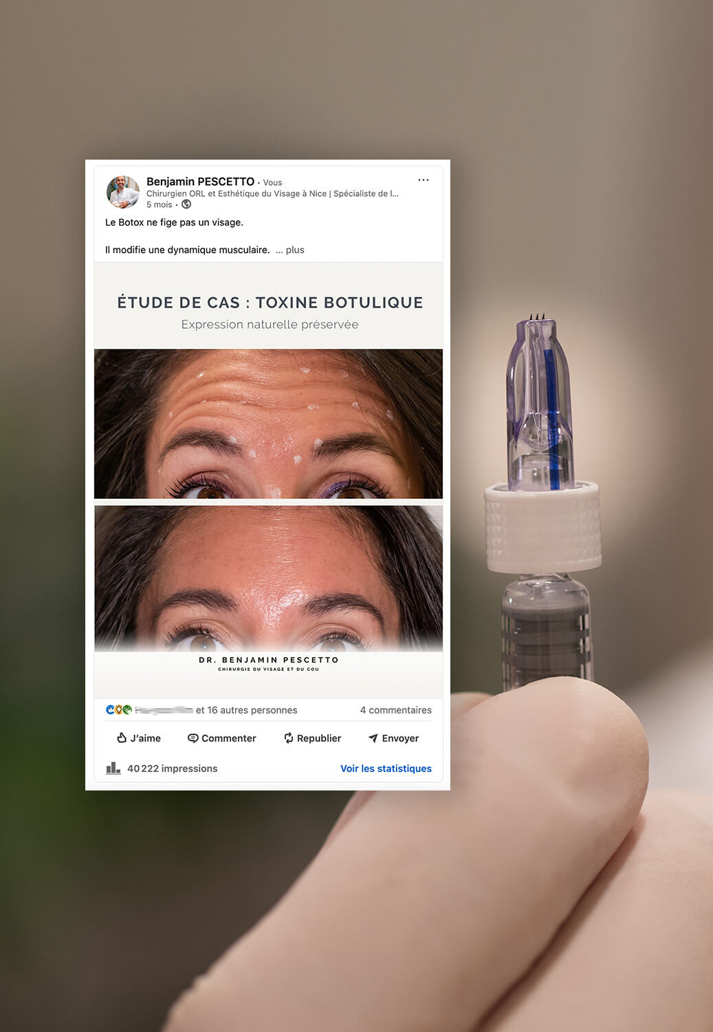 Création de contenus visuels sur le microneedling et la médecine esthétique à Nice