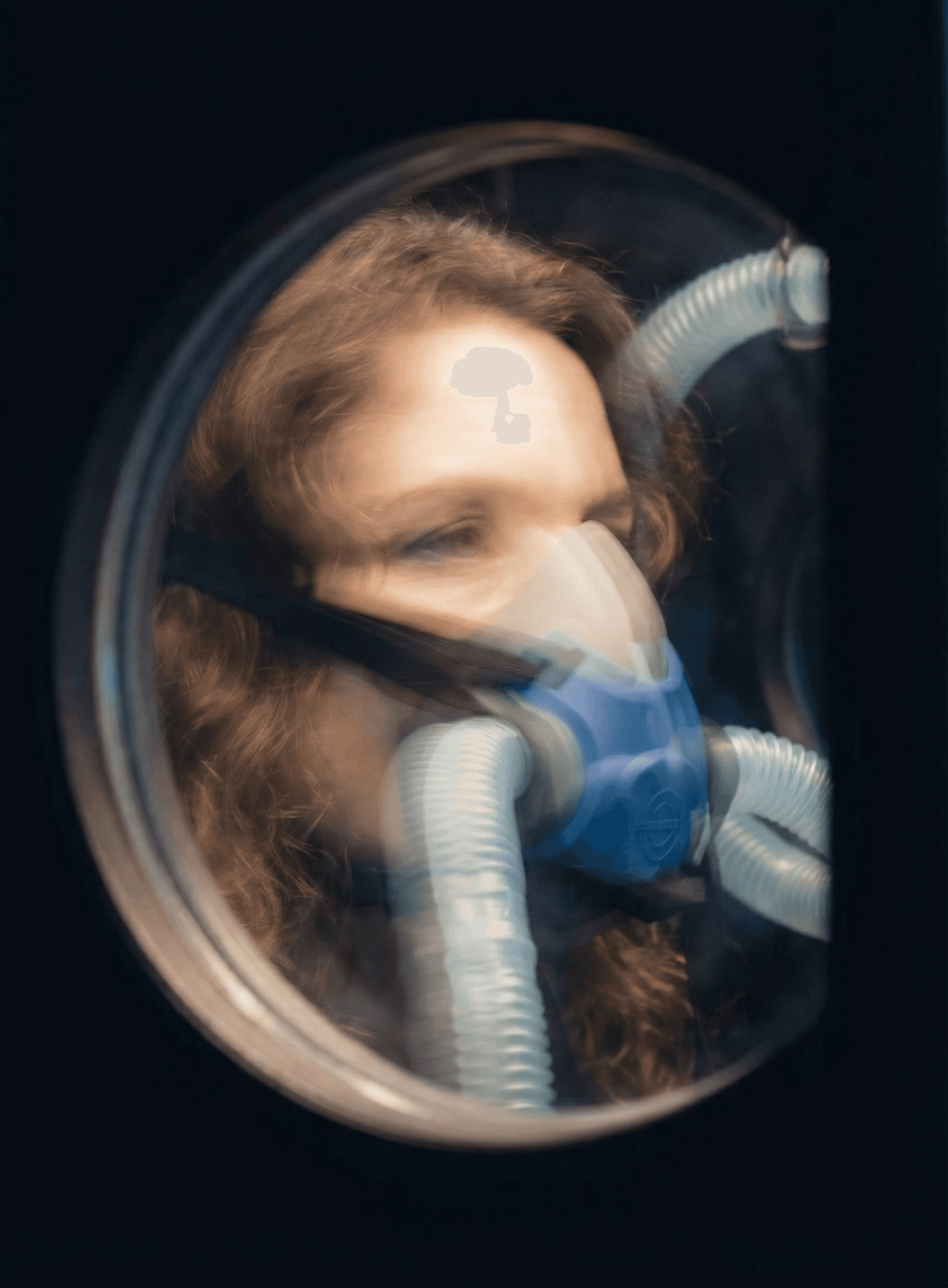 Woman in HBOT Chamber with a BIBS mask