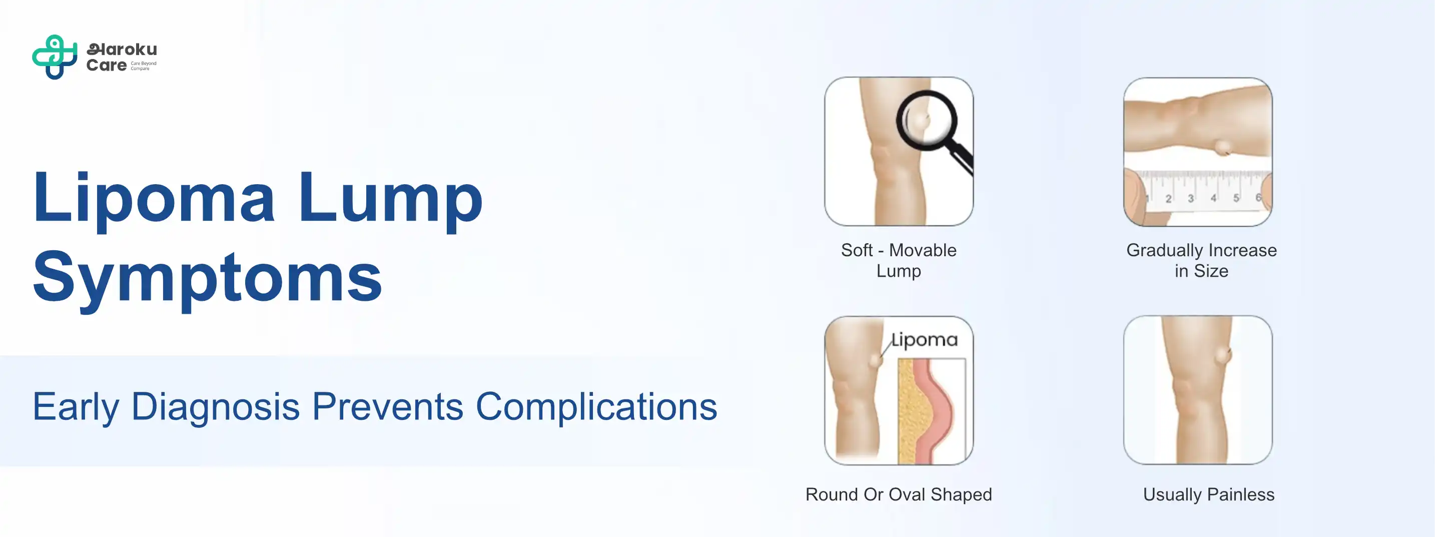 Diagram explaining excess gland and fat tissue in gynecomastia
