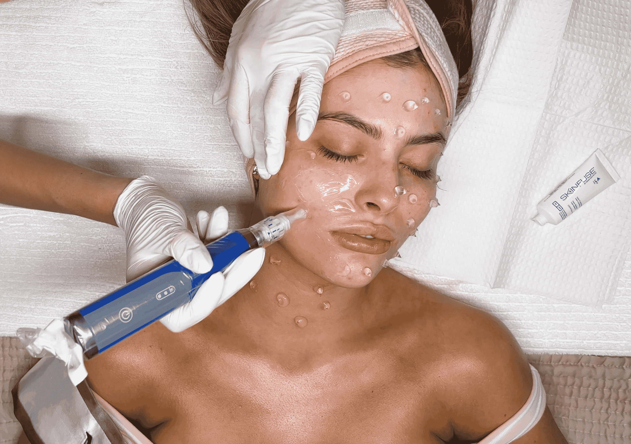 SkinPen® Microneedling to pair with resurfx fractional laser
