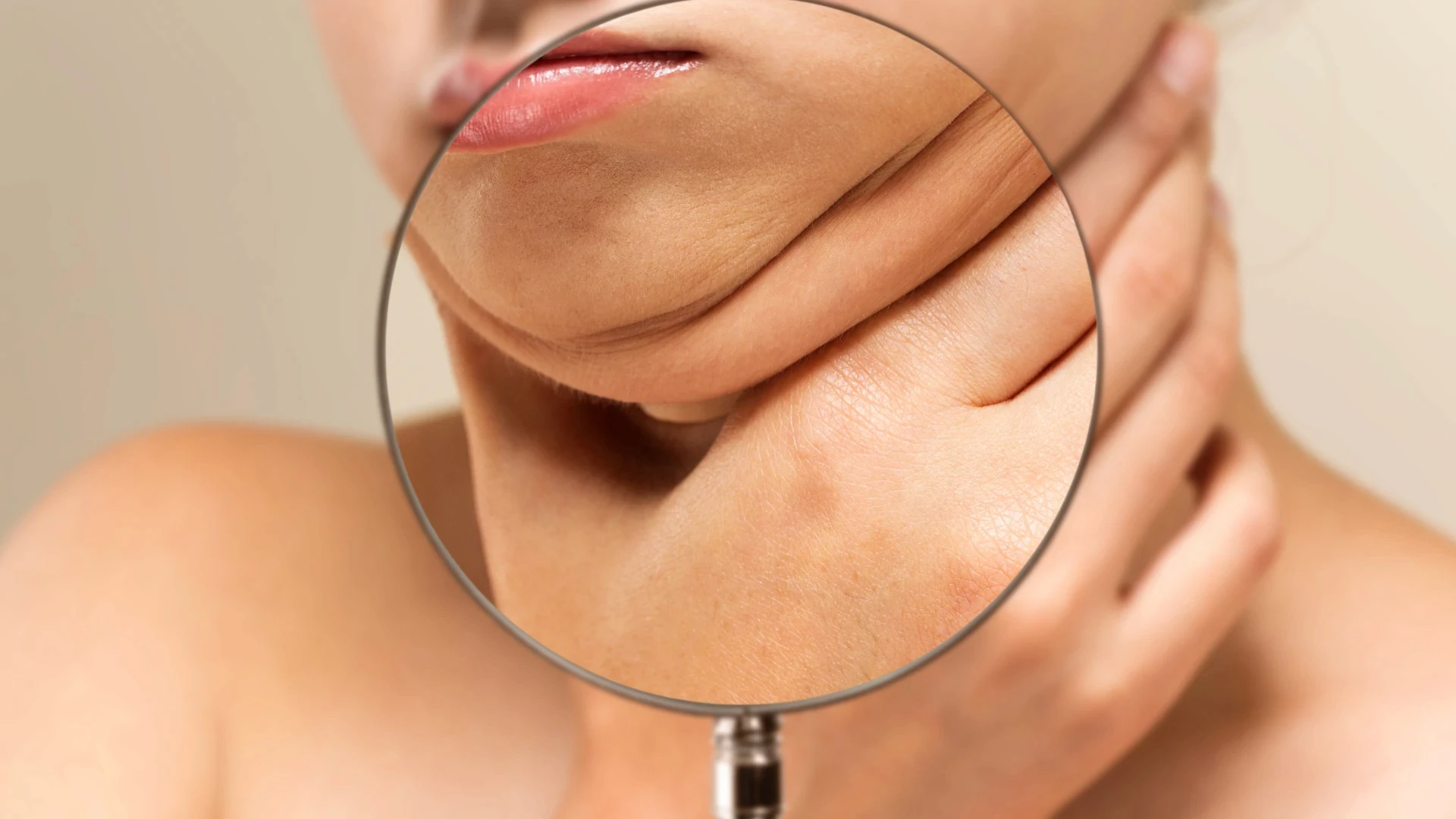 Woman showing submental fullness for double chin reduction treatment in Singapore