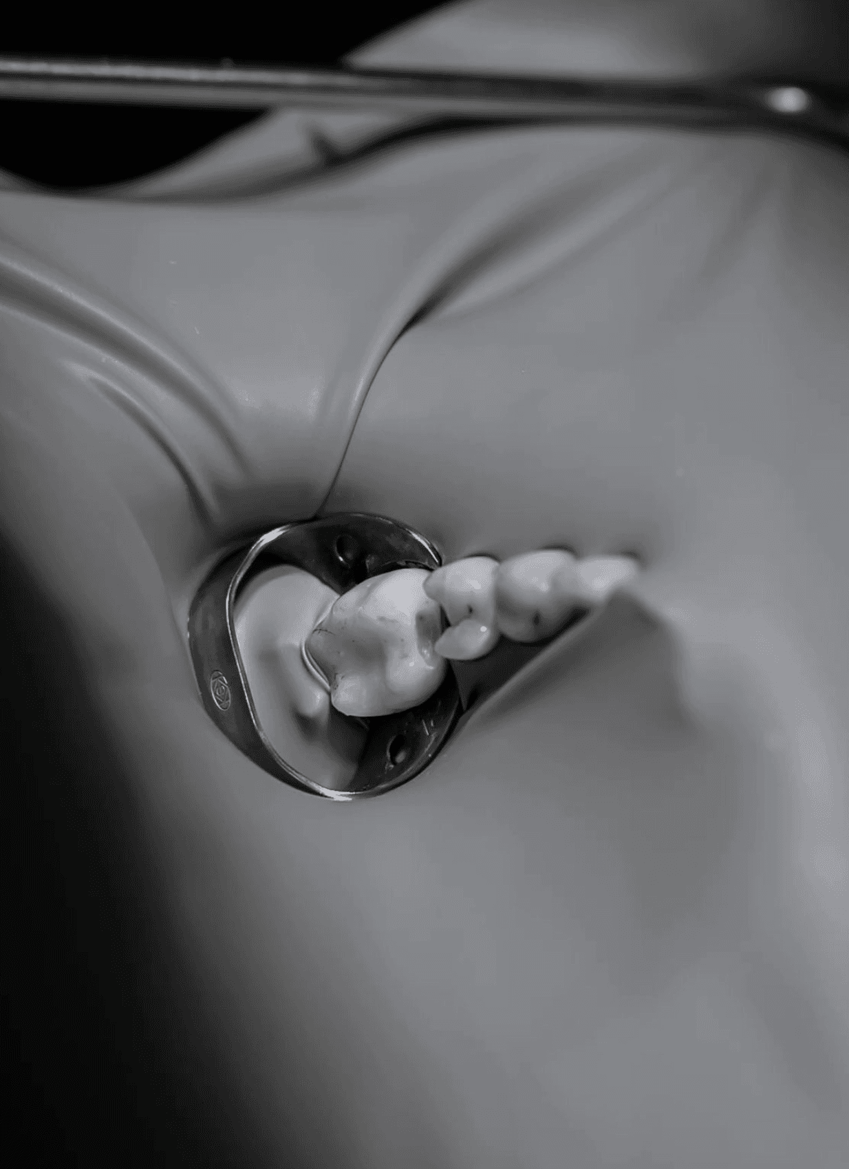 Zahn wird mit Spekulum in medizinischer Untersuchung freigelegt.