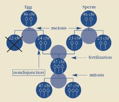 Trisomy 21 (Nondisjunction) cell division