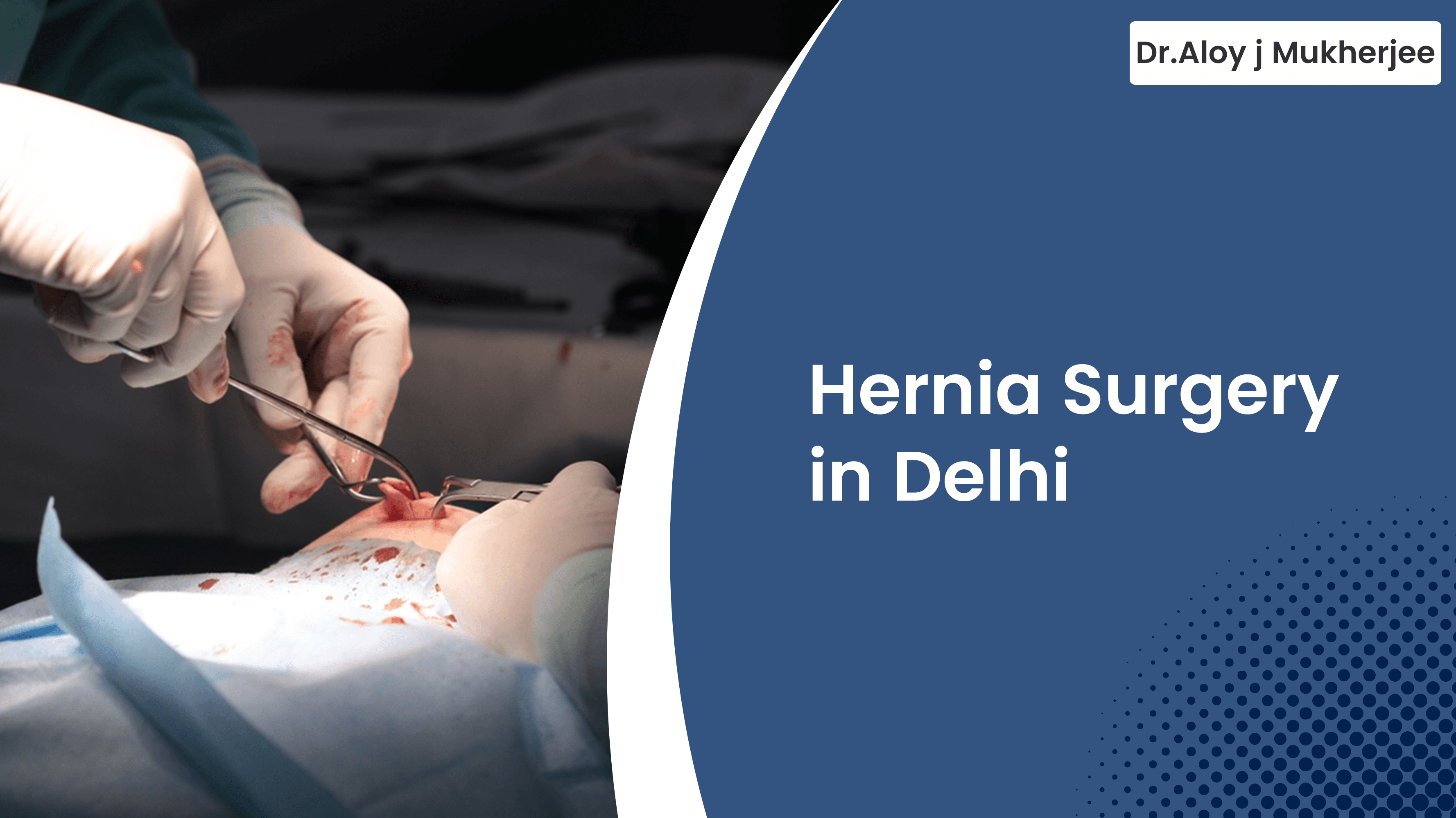 Hernia Surgery in Delhi