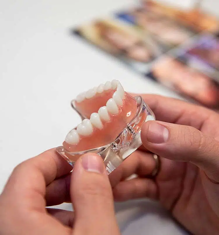 dental implants mineola