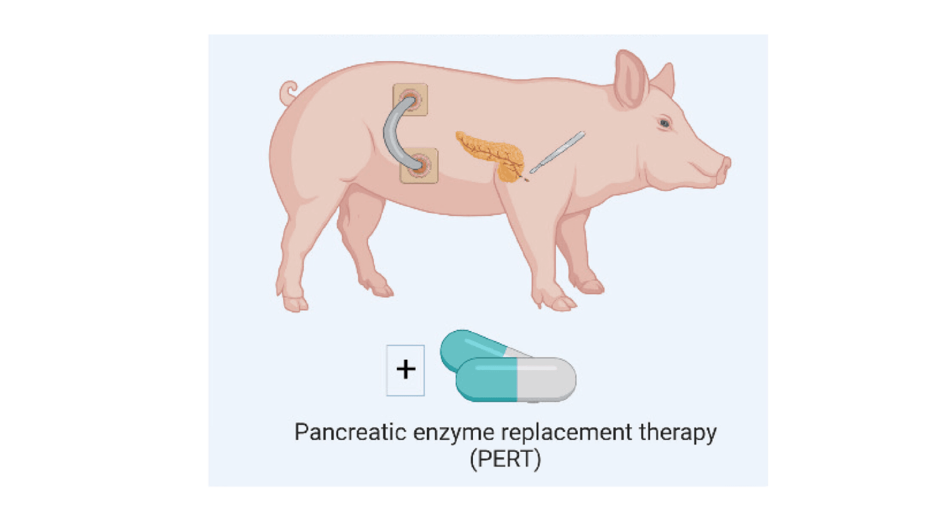 Write Articles with Ease