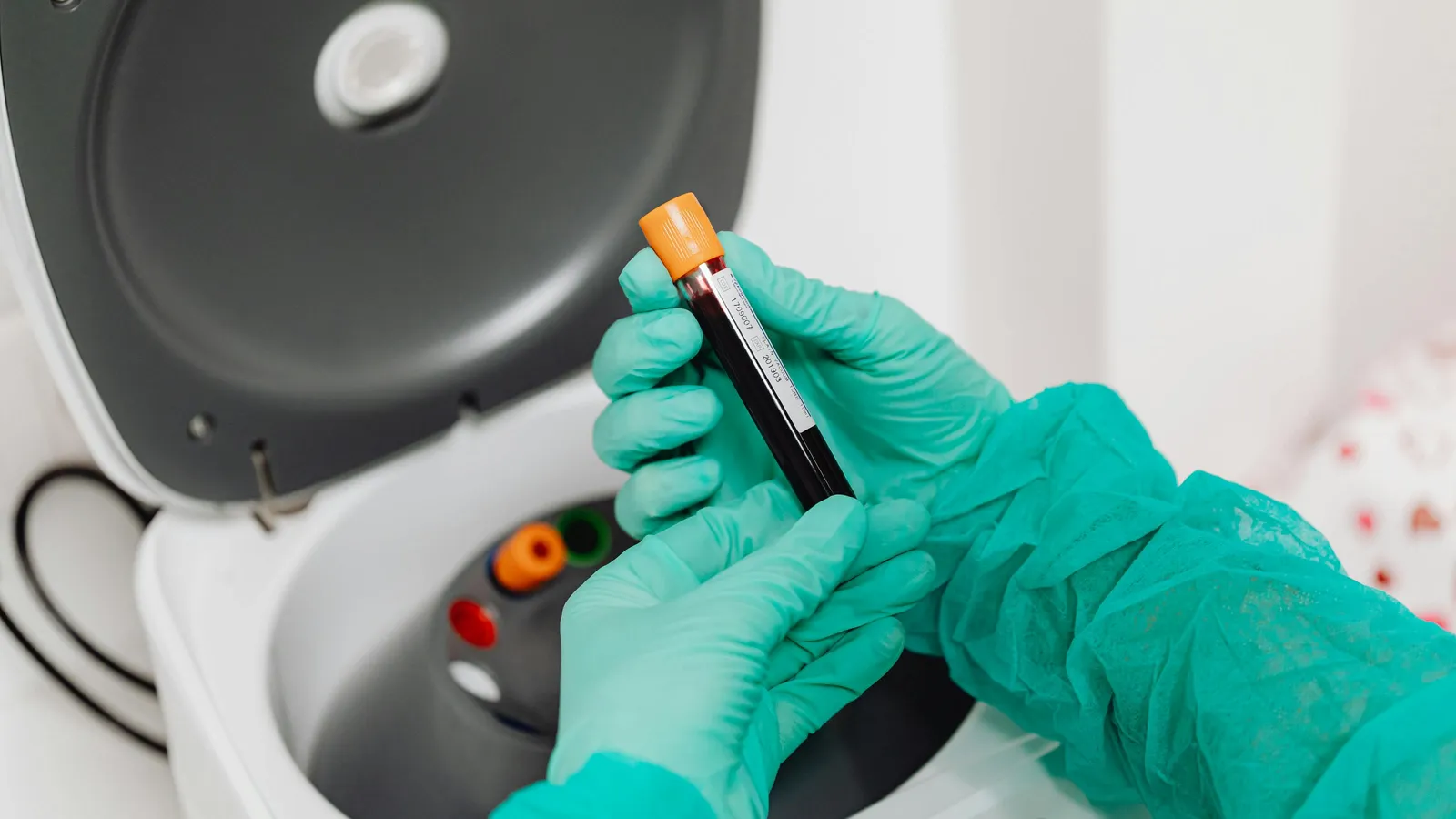 WBC Differential Explained: What Neutrophils, Lymphocytes, and Monocytes Reveal