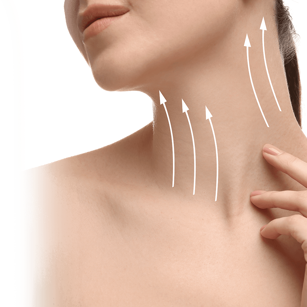 vectors of neck lift surgery