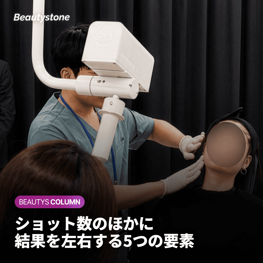 ショット数以外に結果を左右する要素