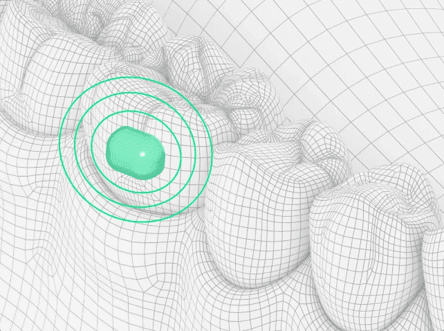 Lura Health's Device
