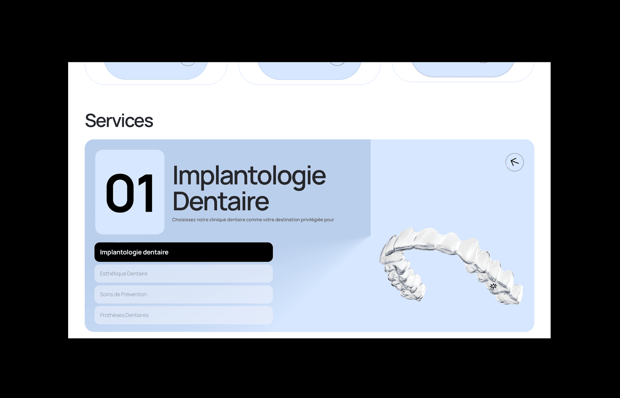 Section des services du Cabinet Dentaire Jollant avec un focus sur l'implantologie dentaire