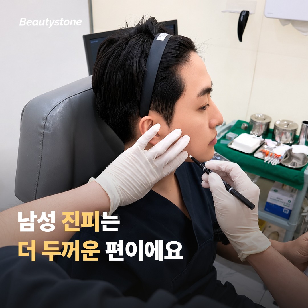 남성 피부가 열에 다르게 반응하는 이유
