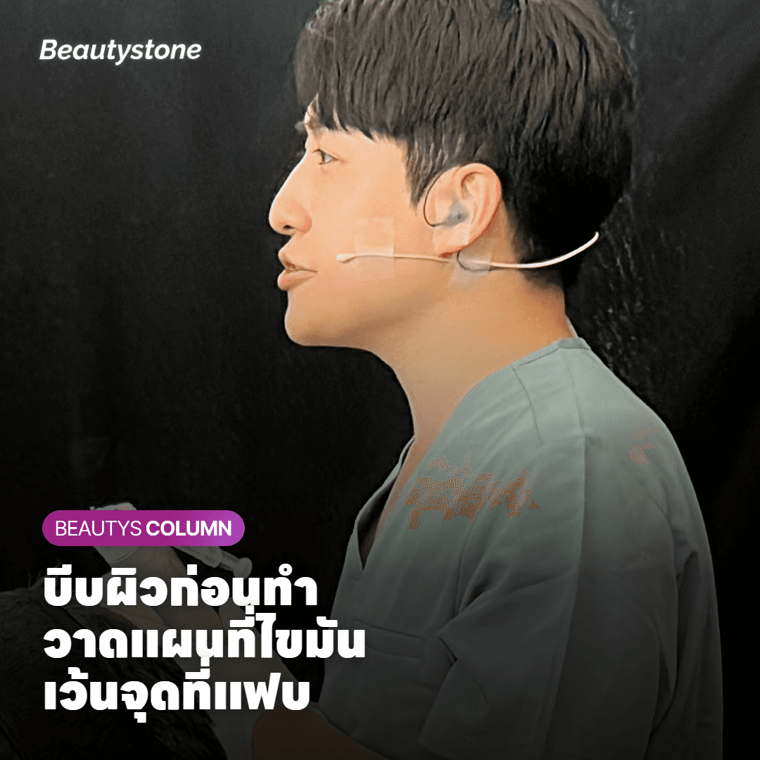 ทำไมต้องบีบผิวและวาดแผนที่ไขมันบนหน้าก่อนเริ่ม?