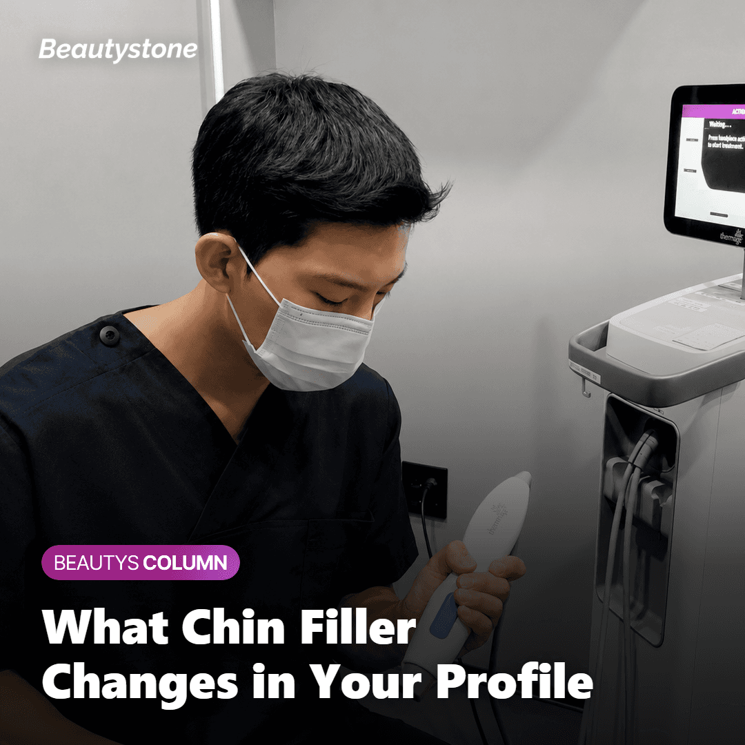 Illustration of how chin filler changes profile projection and jawline definition