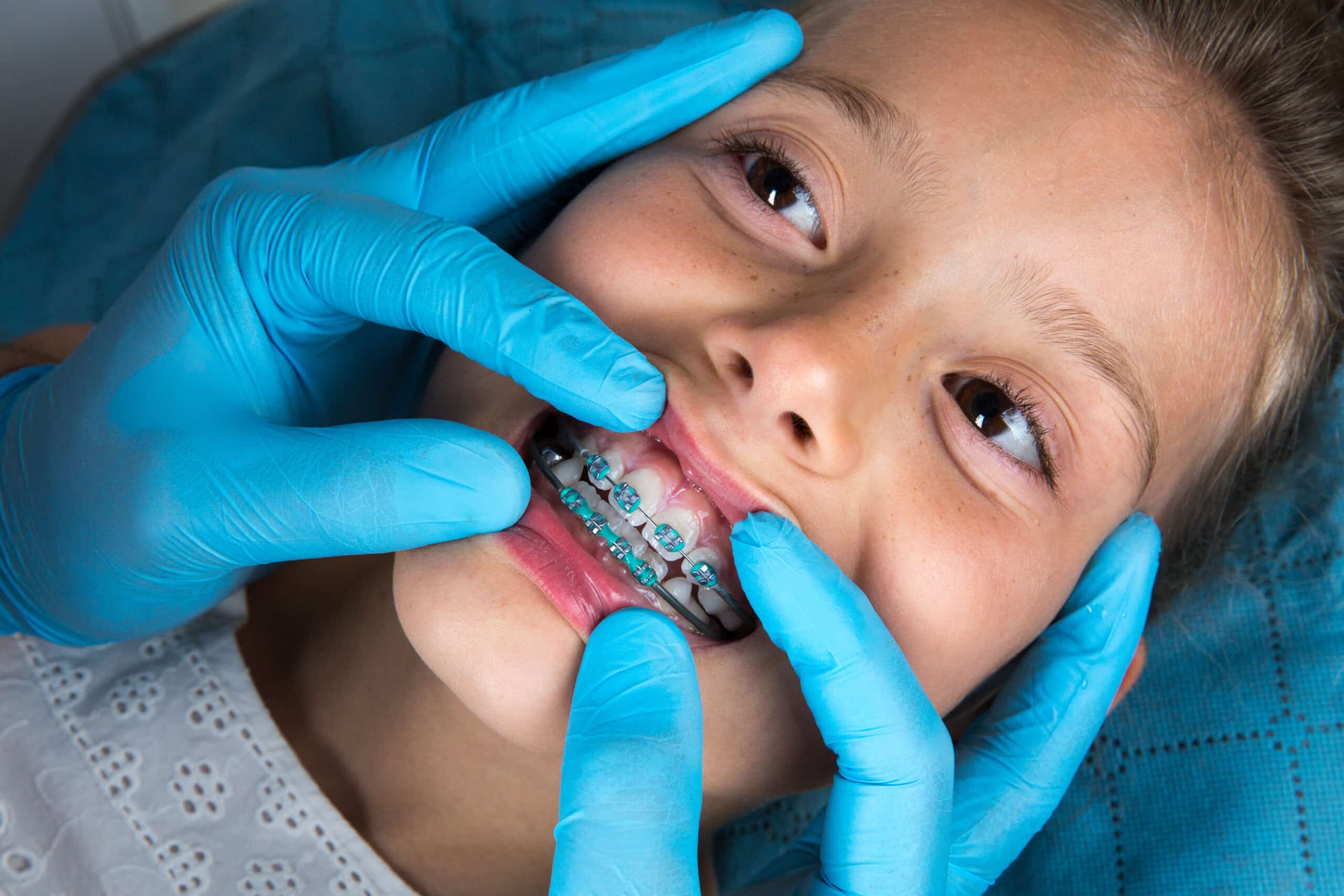 Orthodontic treatment for kids