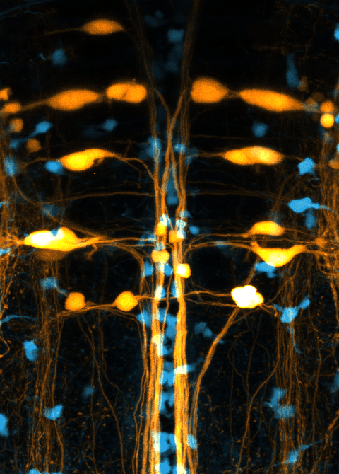 Fluorescent microscopic image of the hindbrain of a transgenic zebrafish larvae looking from the top.