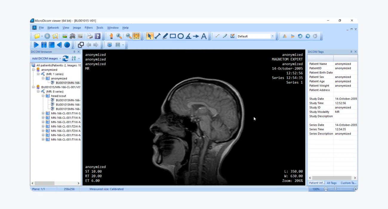 MicroDicom: Advanced DICOM Reader and Processor