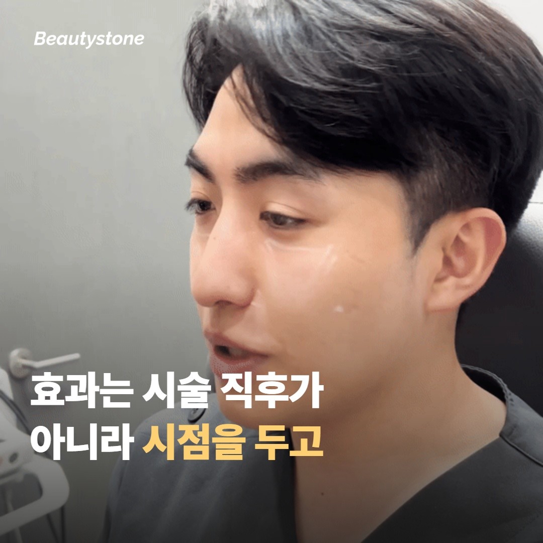 효과는 시술 직후가 아니라 시점을 두고 평가해요