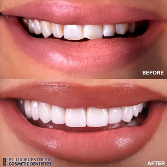 Cosmetic Dentistry