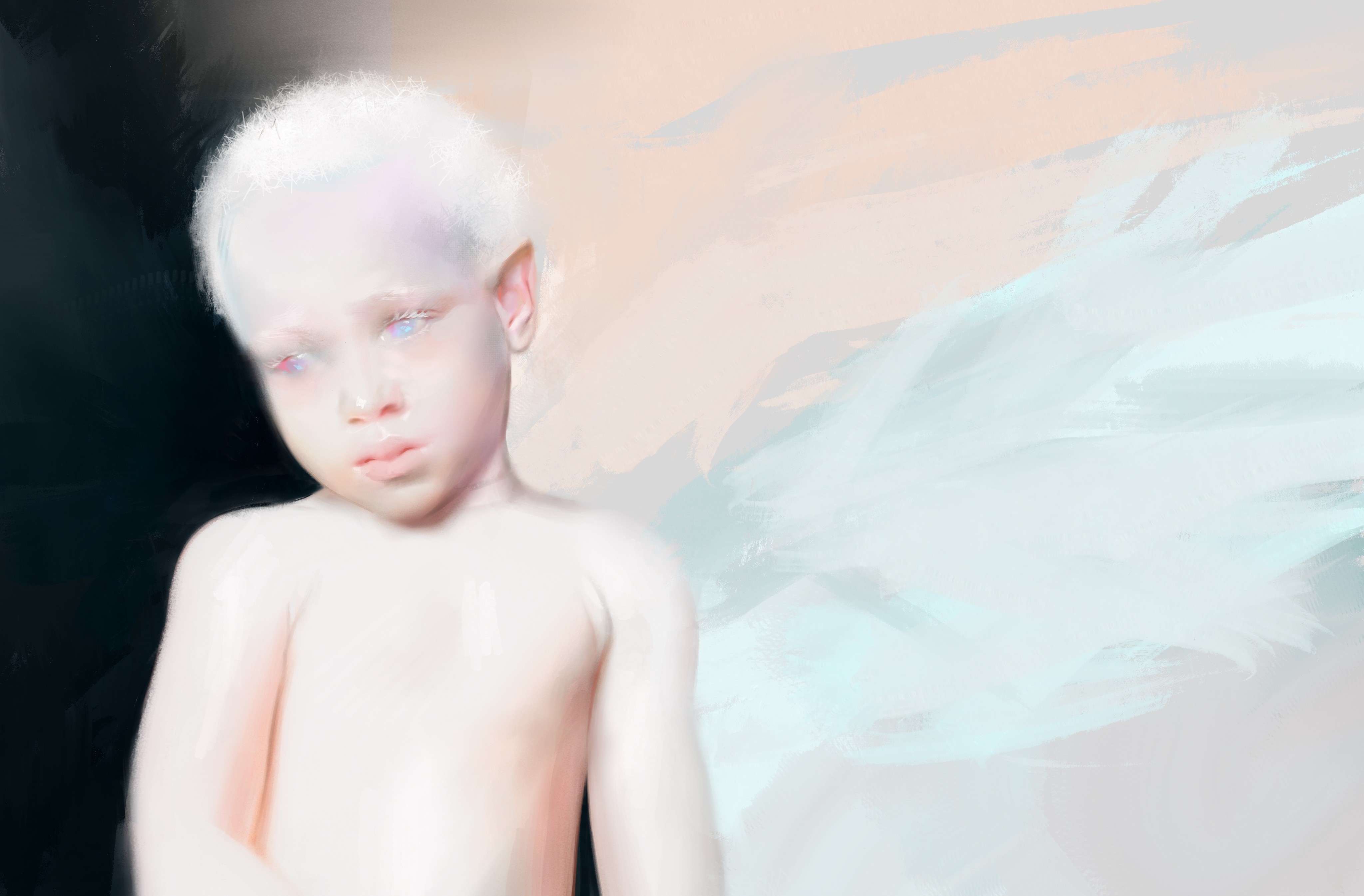 Albinos child