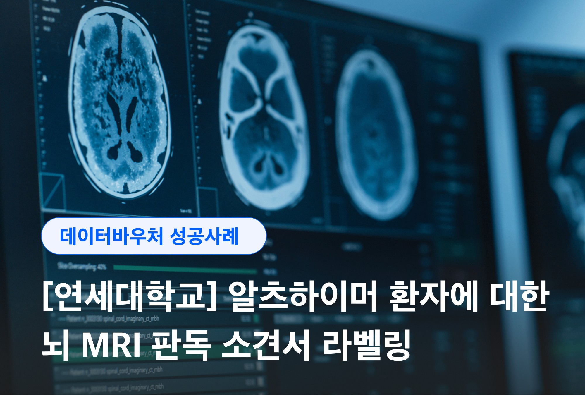 점심 식사의 당질 수치를 분석하고, 하루 총 섭취량에 대한 피드백을 제공하는 식단 관리 에이전트의 UI 이미지