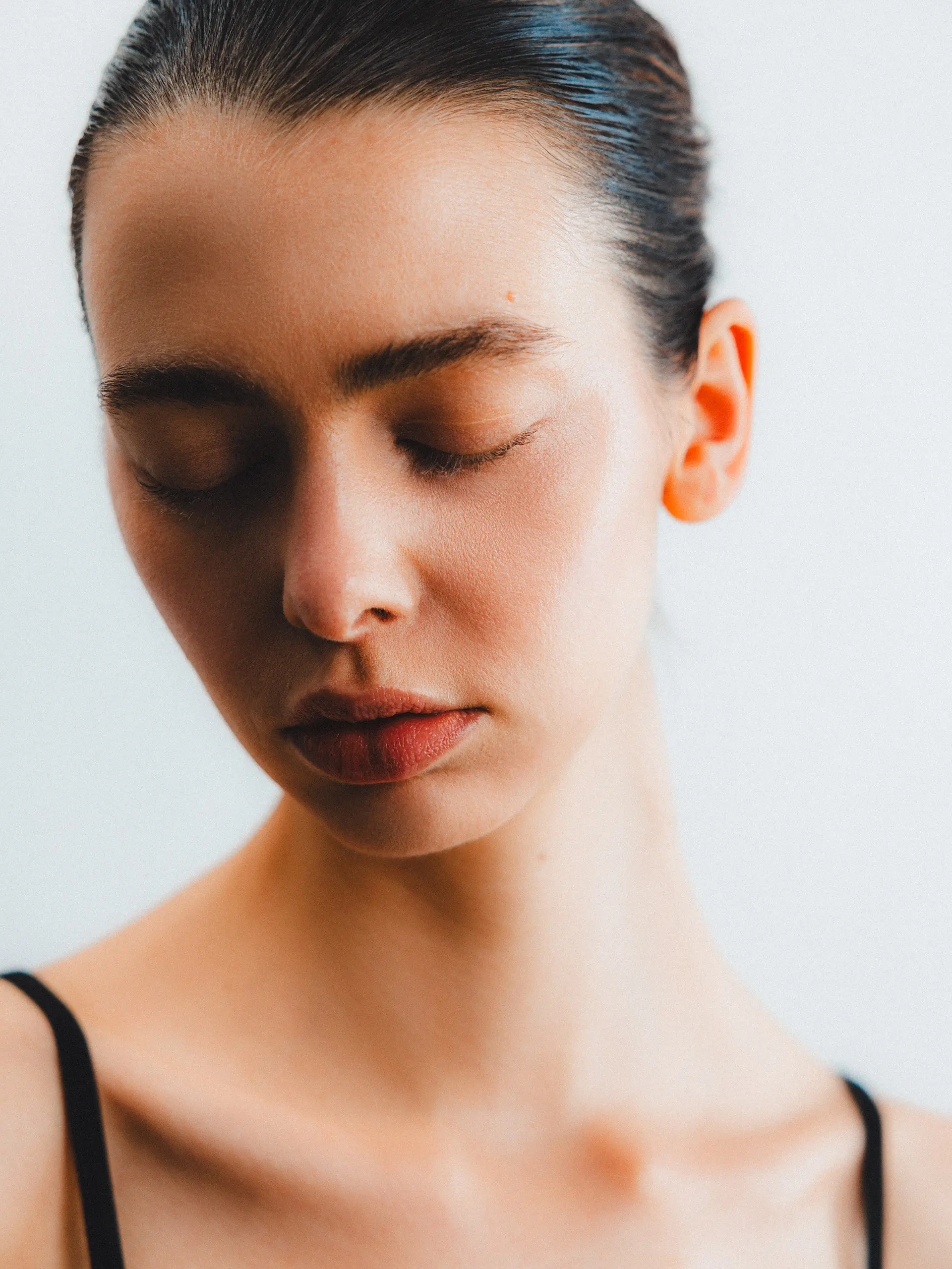 moxi full face aesthetic vancouver