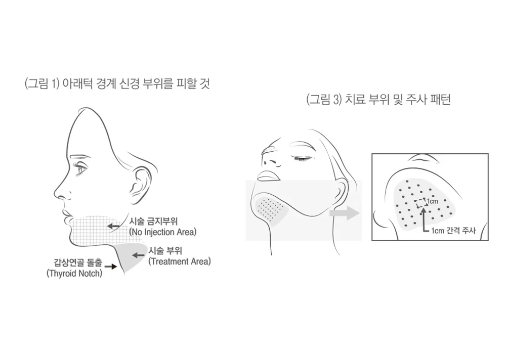 v-olet Proper injection location and dosage