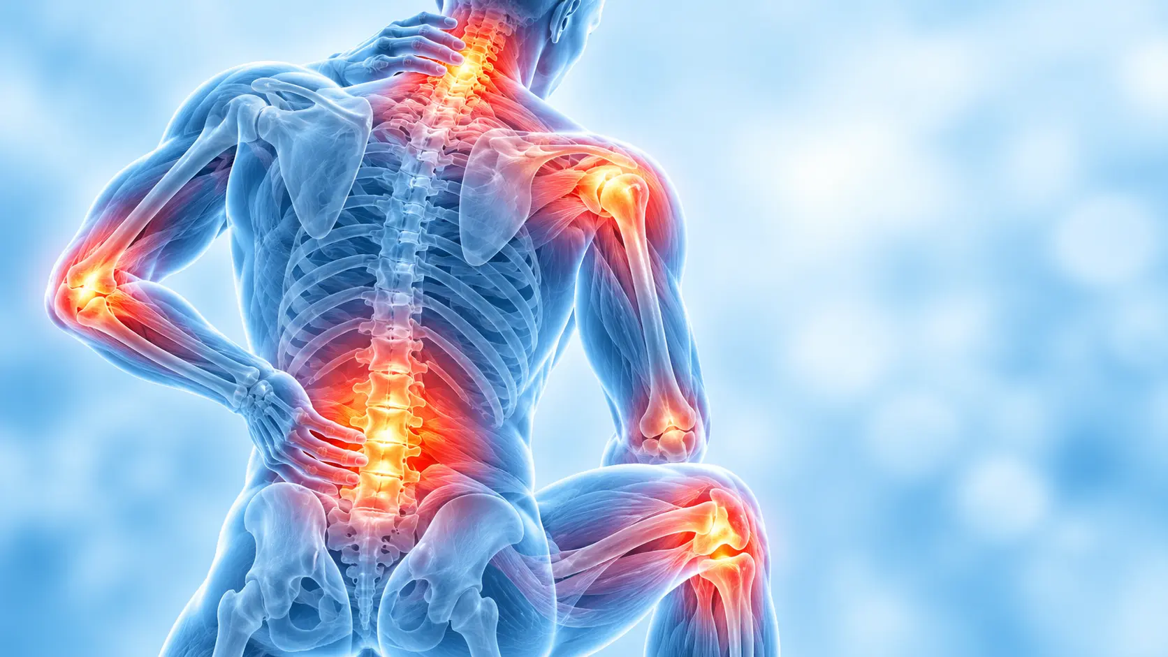 Chronic pain affecting multiple joints and the spine