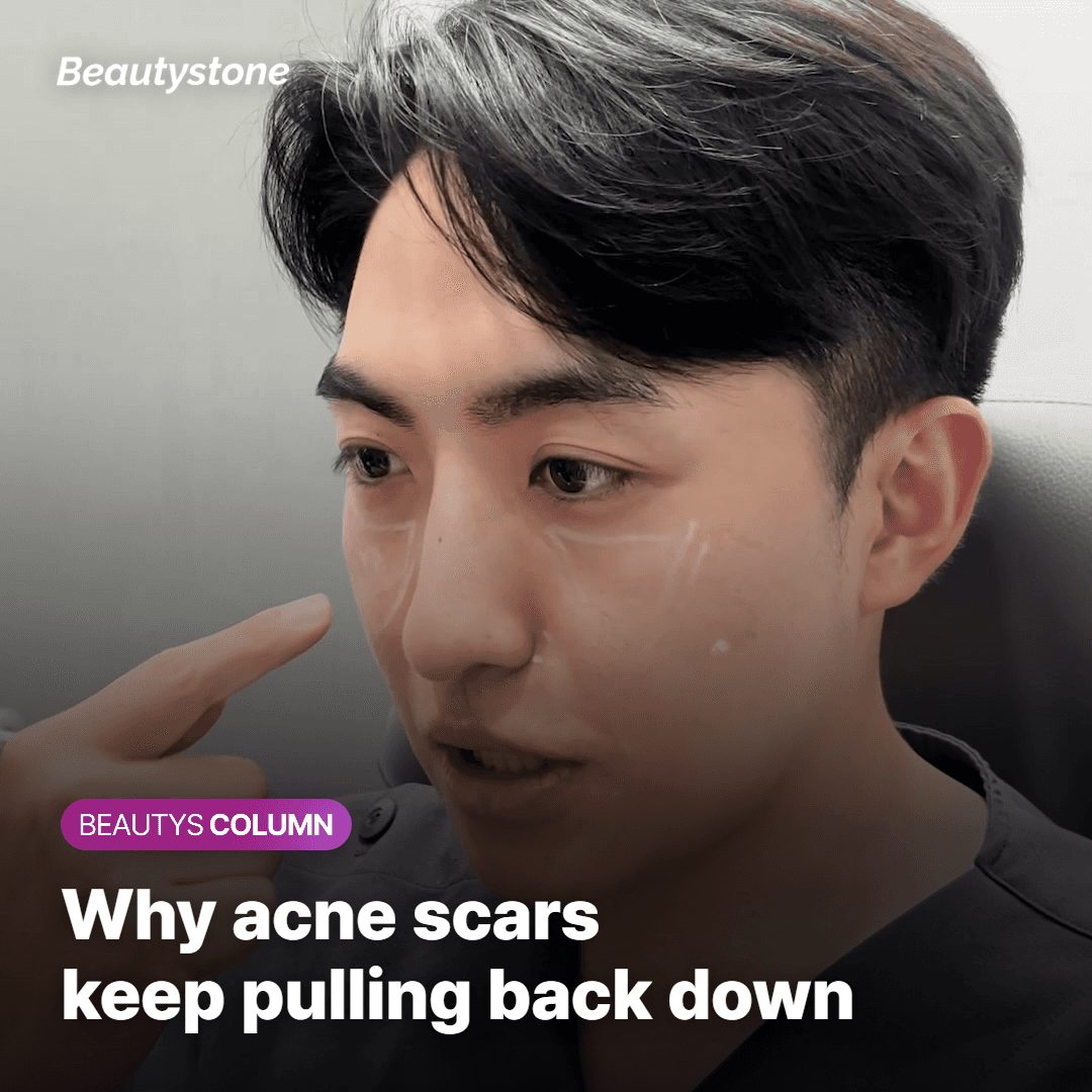 Why is It So Effective for Acne Scars?