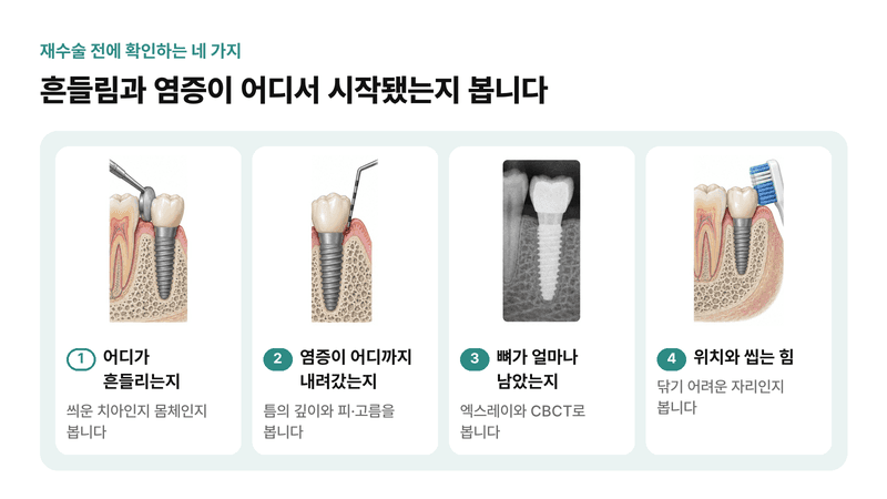흔들리는 부위, 염증 깊이, 남은 뼈, 위치와 씹는 힘까지 임플란트 재수술 전에 확인하는 네 가지를 그린 일러스트