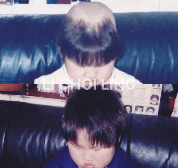 lichoiling casestudy