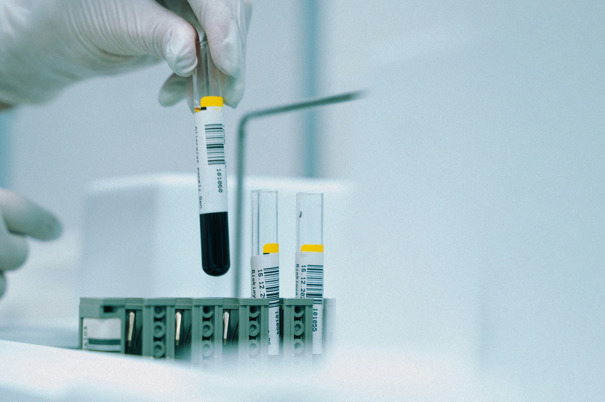 Blood sample tubes in a laboratory rack during testing.