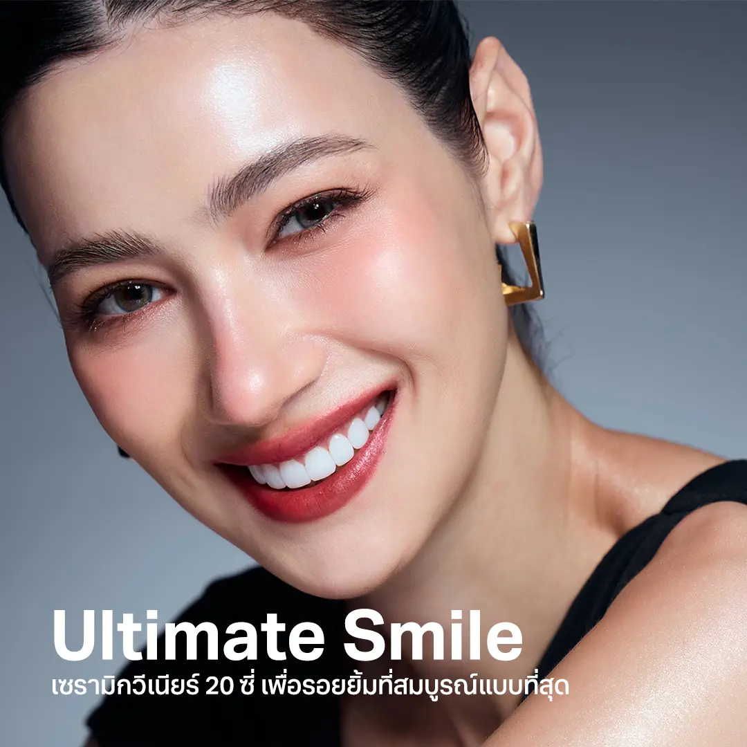ultimate smile โปรโมชั่น วีเนียร์ 2025 ราคาเท่าไหร่ cosdent smile design