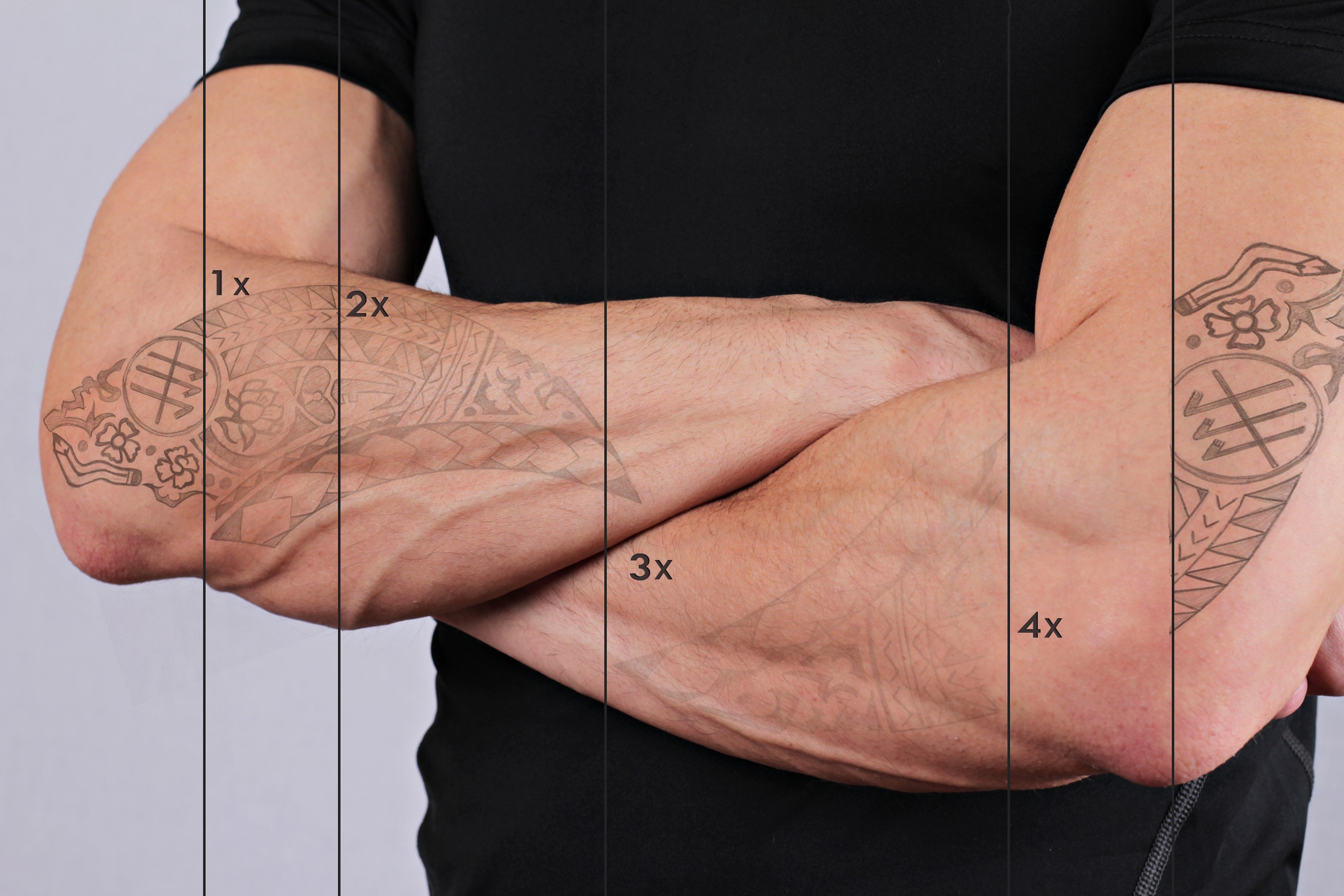 Expertos en "Eliminación de tatuajes (Láser)" en Terrassa, Barcelona. Heaven Clinics