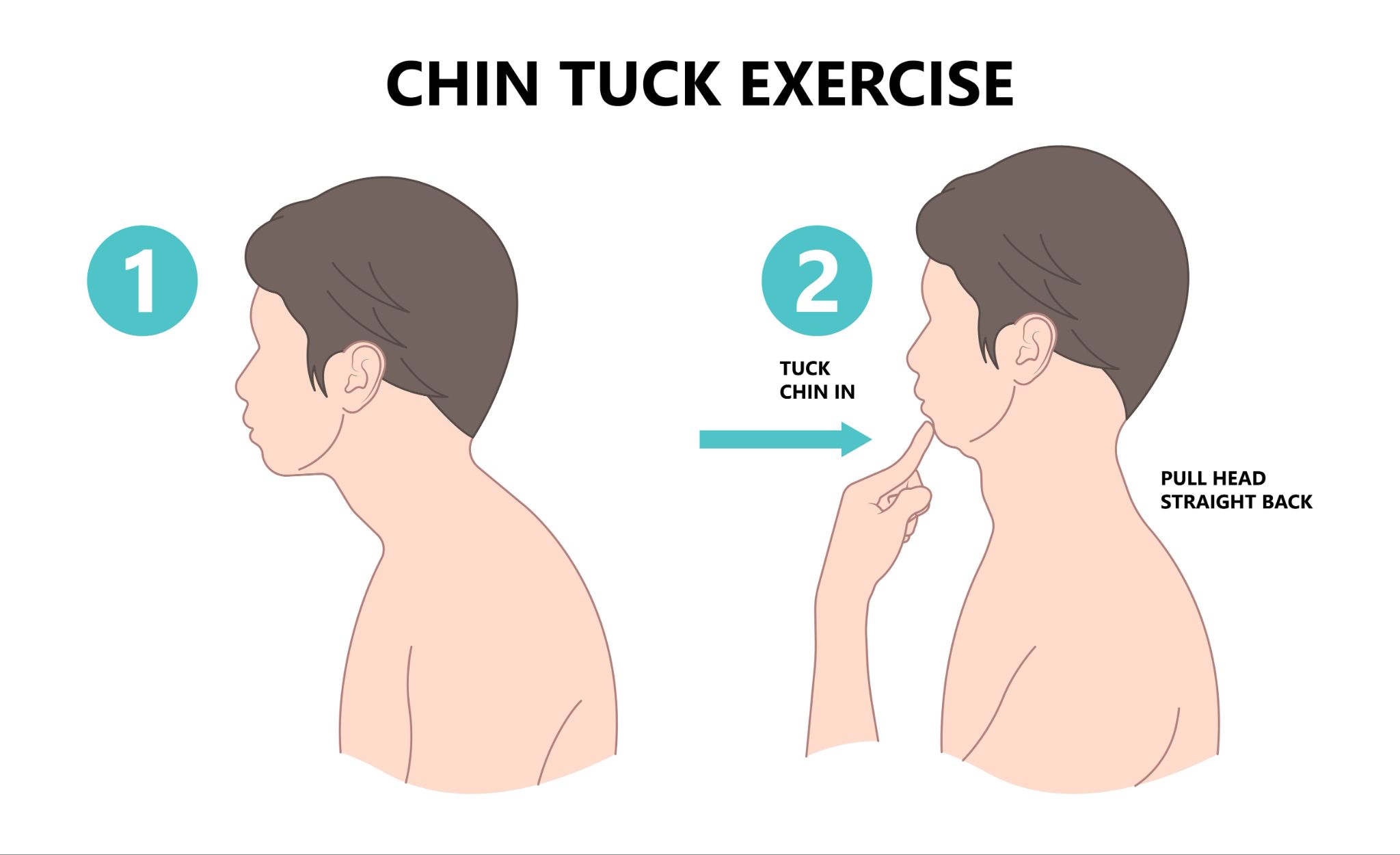 A two-step instructional diagram for a chin tuck exercise, showing a side profile of a person correcting forward head posture by pulling their head straight back.