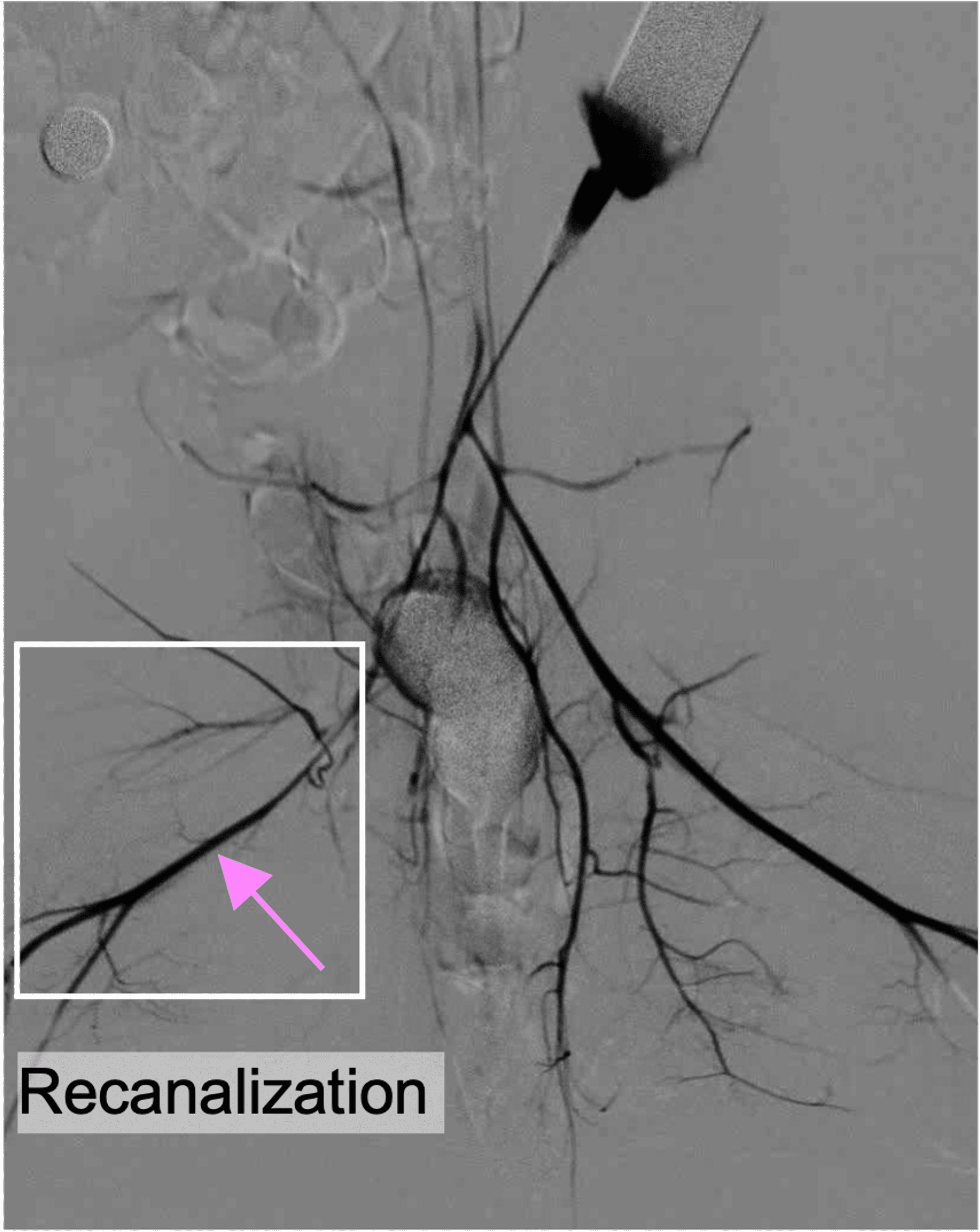 Coach explaining stuff to an athlete