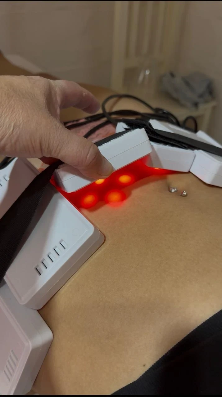 Lipo Láser