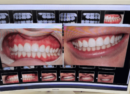 3D Dental X-Rays in Scarborough, ON | Top-Rated Dentist in Scarborough, ON.