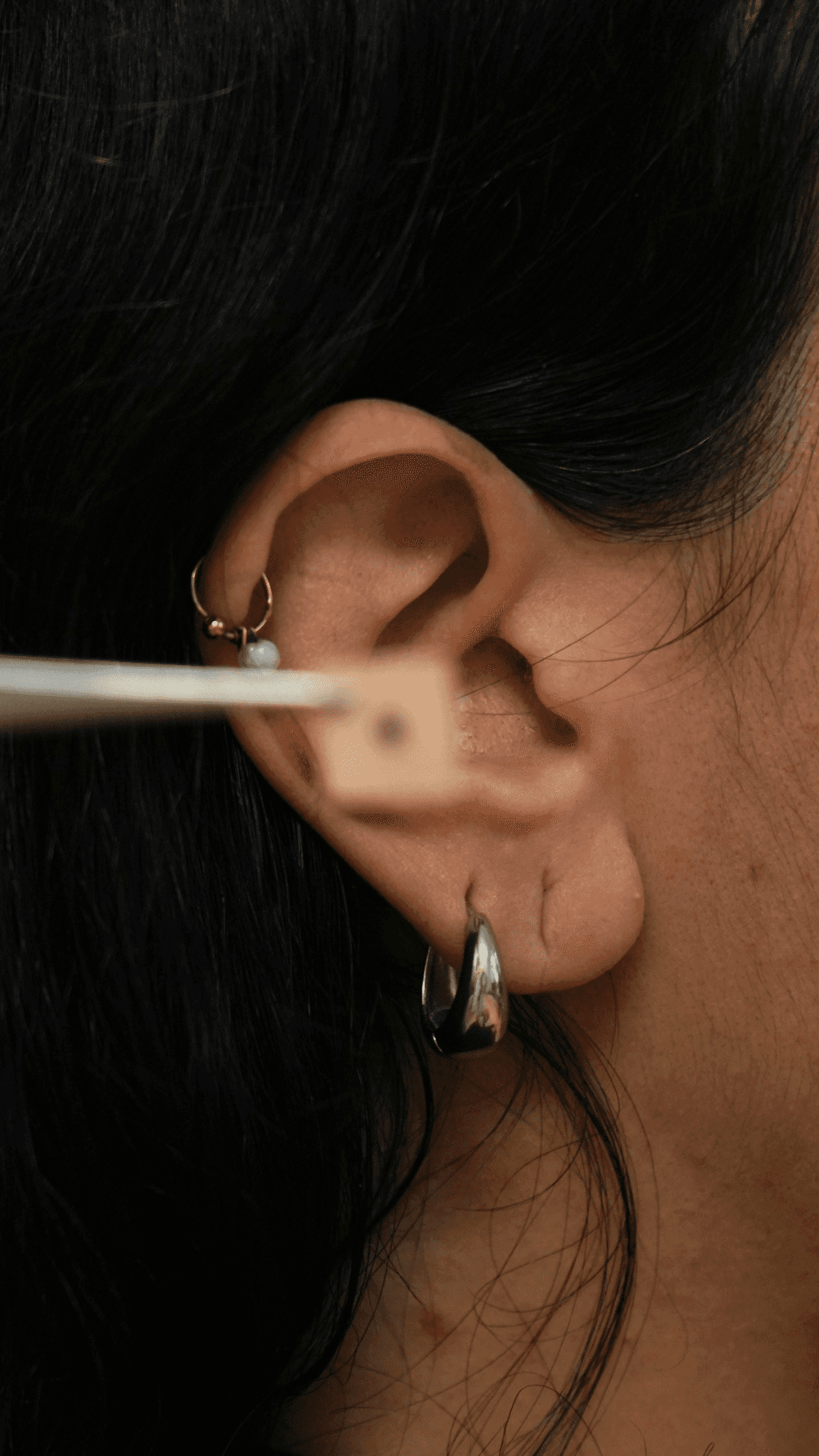 Ear of a patient