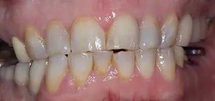Before Image