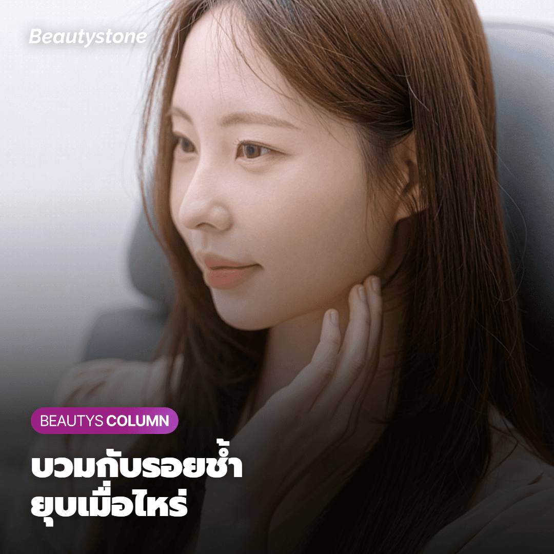 ปกติแล้วอาการบวมและรอยช้ำจะยุบลงในวันที่เท่าไหร่กันนะ?