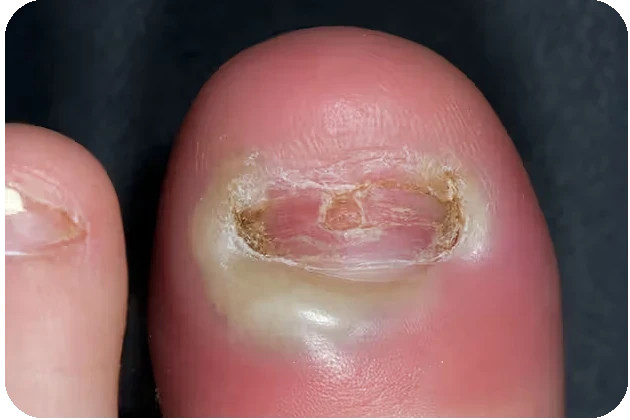 Red/swollen skin